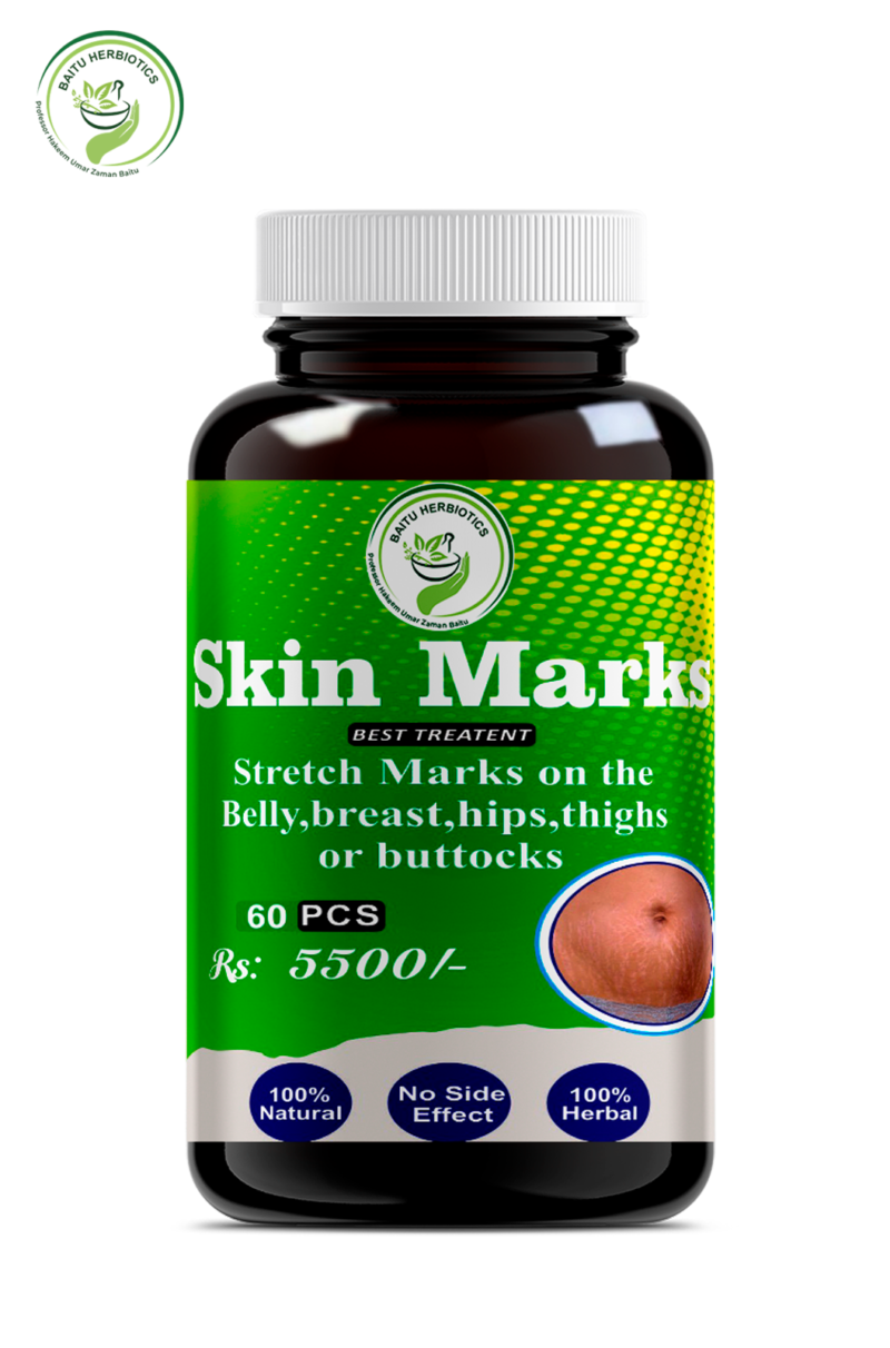 Skin Marks Treatment Arifwala – Herbal Skin Marks Cap