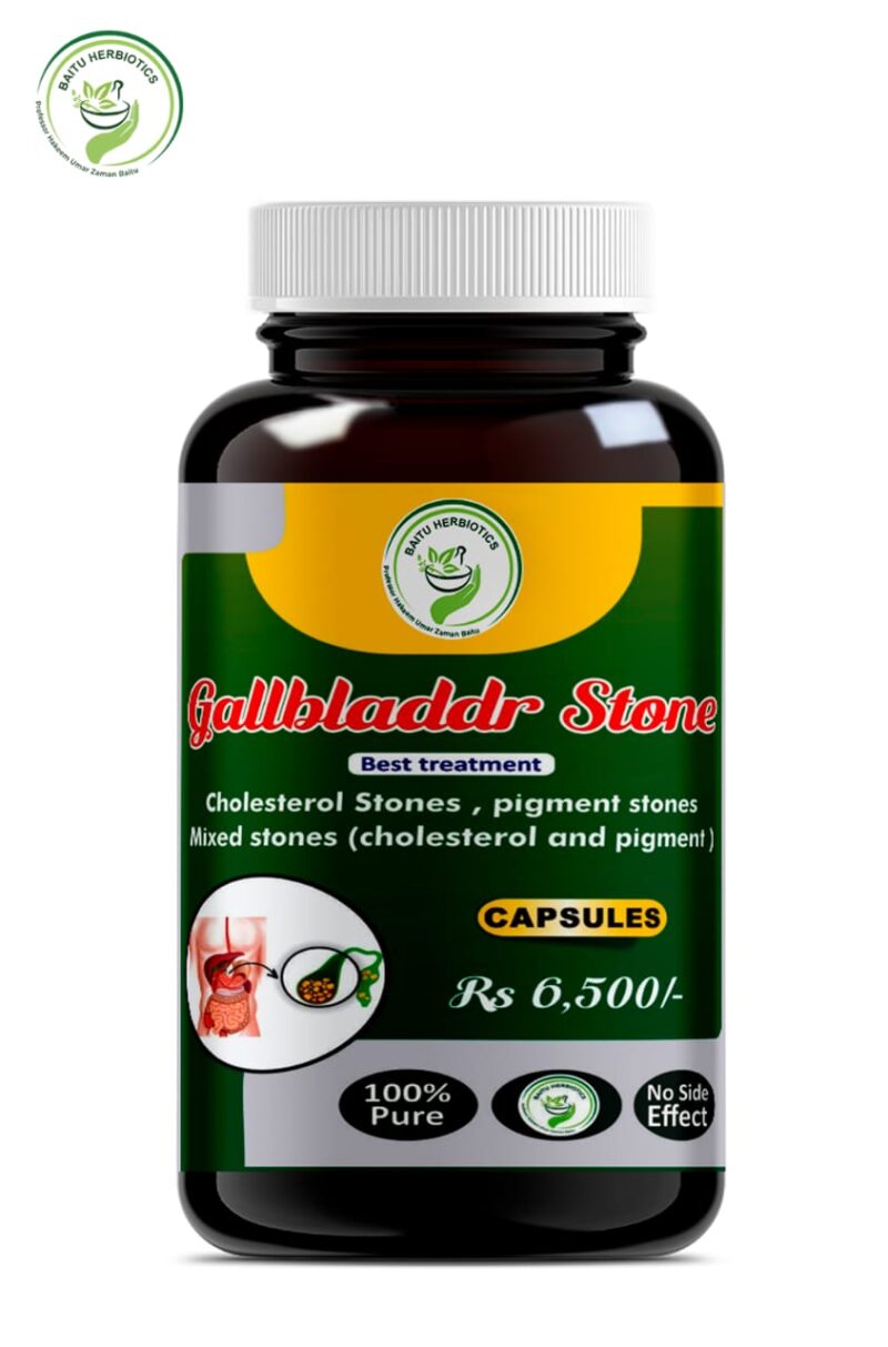 Gallbladder Stones Cap