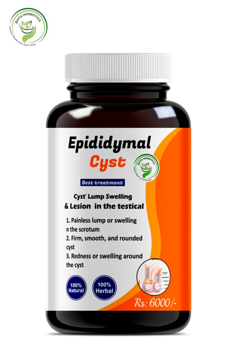 Epididymal Cyst