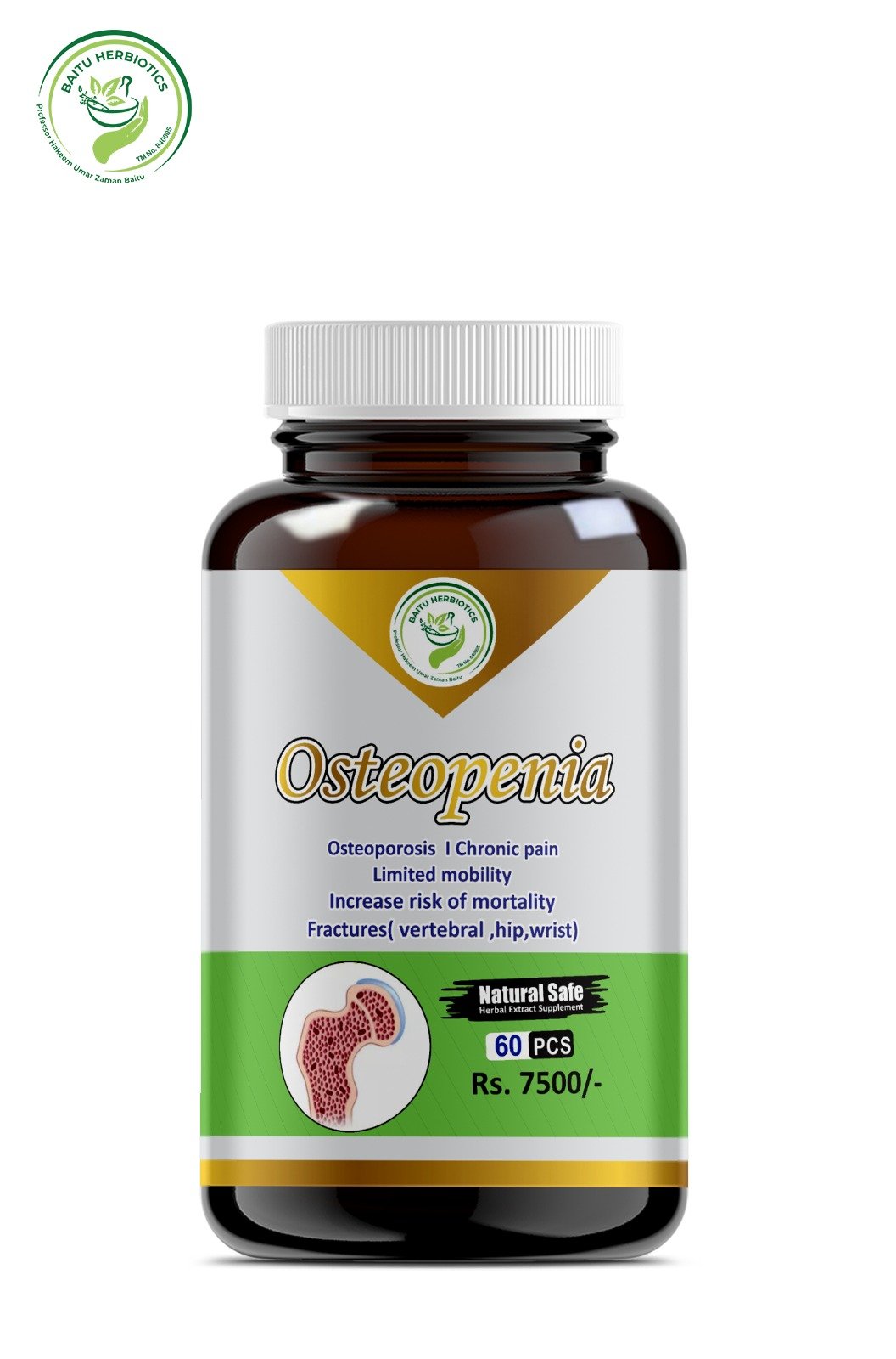 Osteopenia Cap